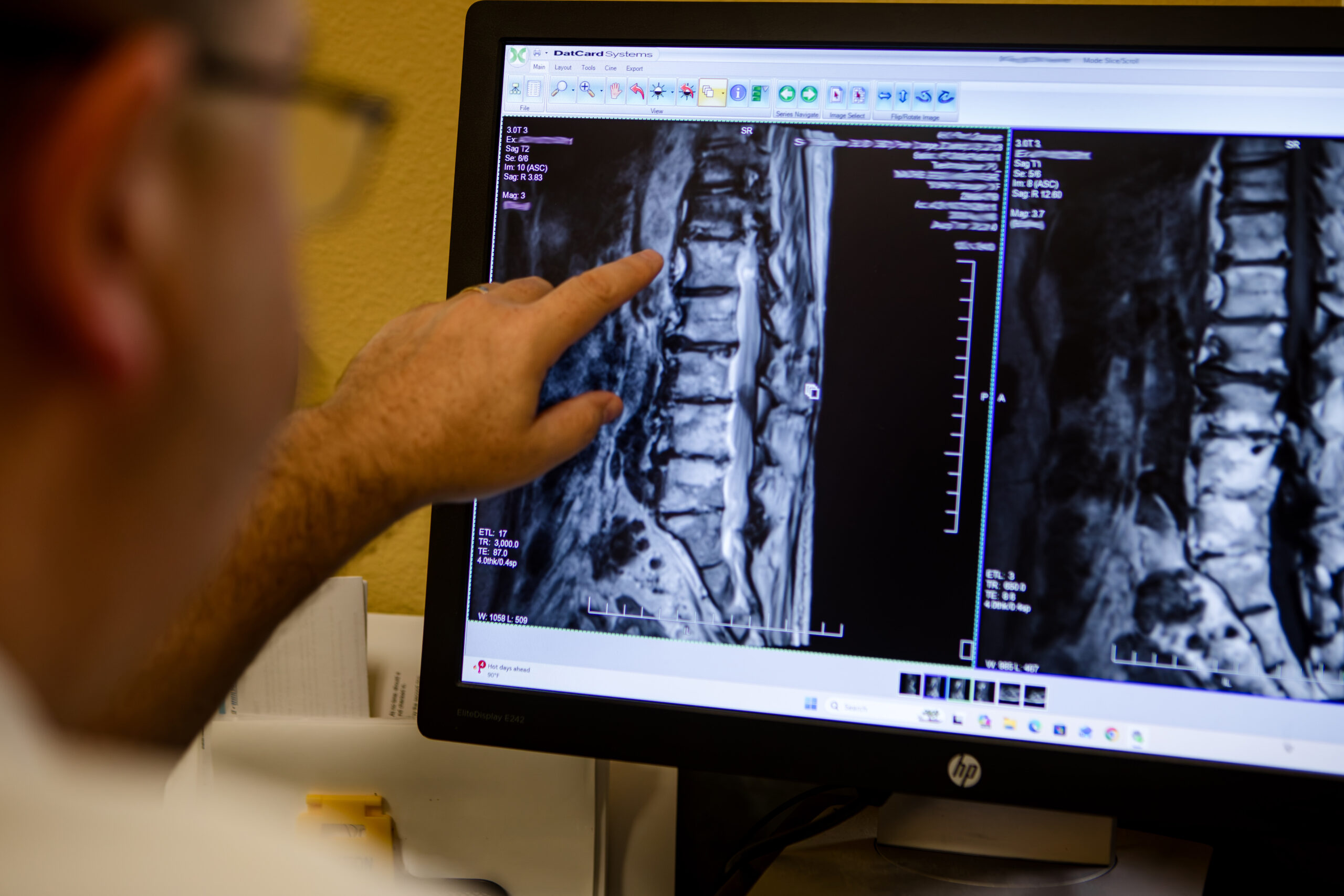 Dr. Cox pointing to a lumbar MRI on screen while reviewing imaging at Insight Chiropractic in Ormond Beach
